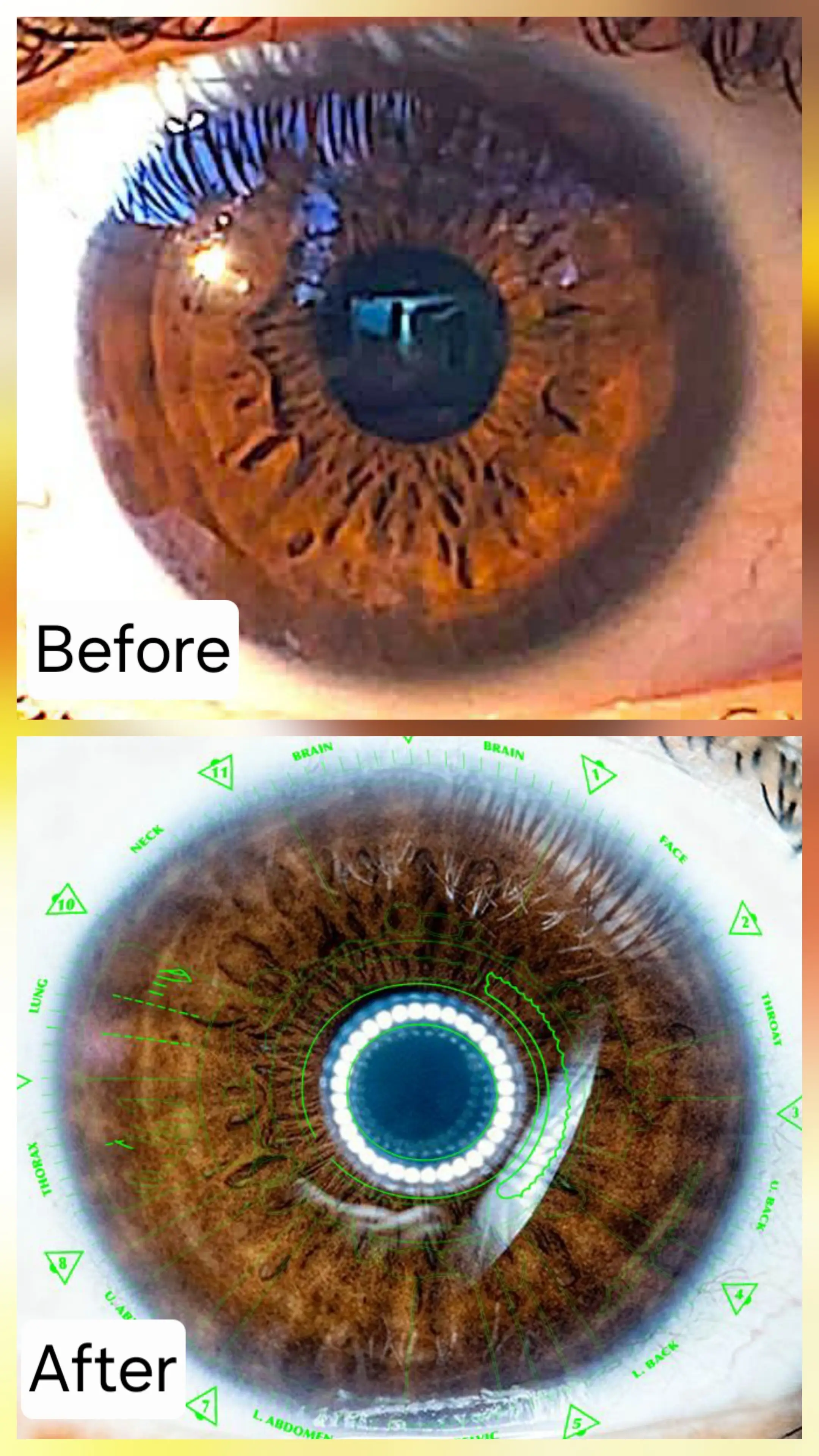 Custom healing plan results showing digestive health restoration