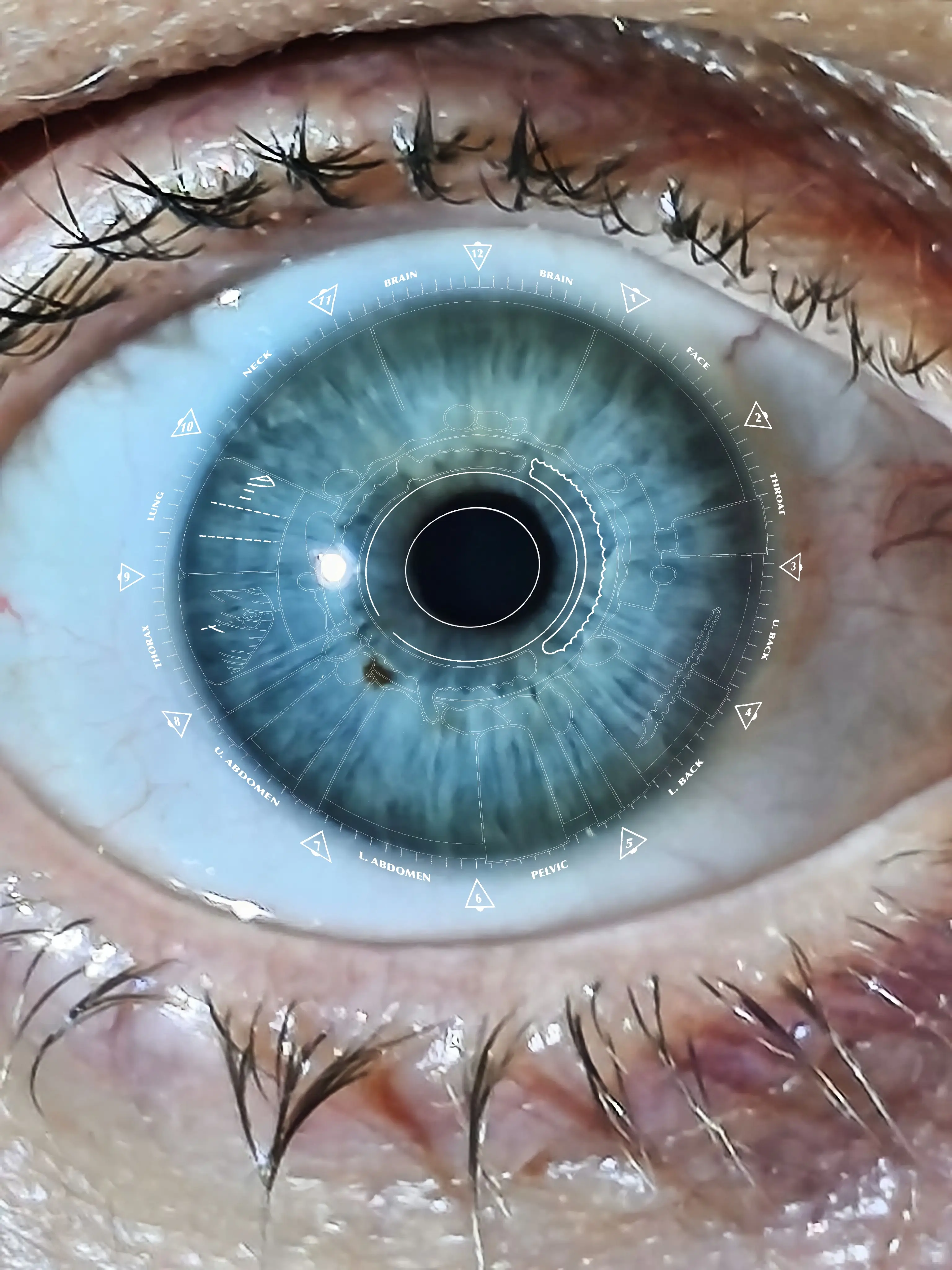 Professional iris analysis checking genetic weaknesses and lymphatic congestion