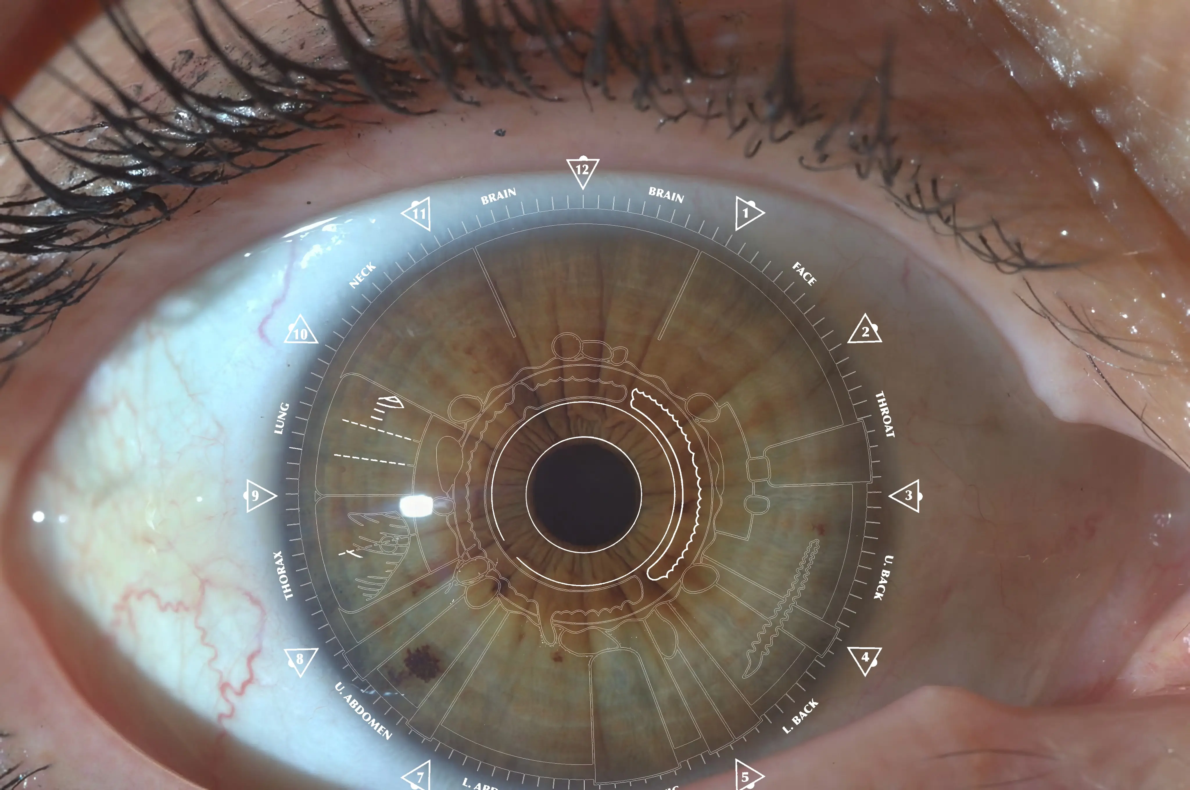 Naturopathic iris assessment showing cellular detox and digestive health indicators