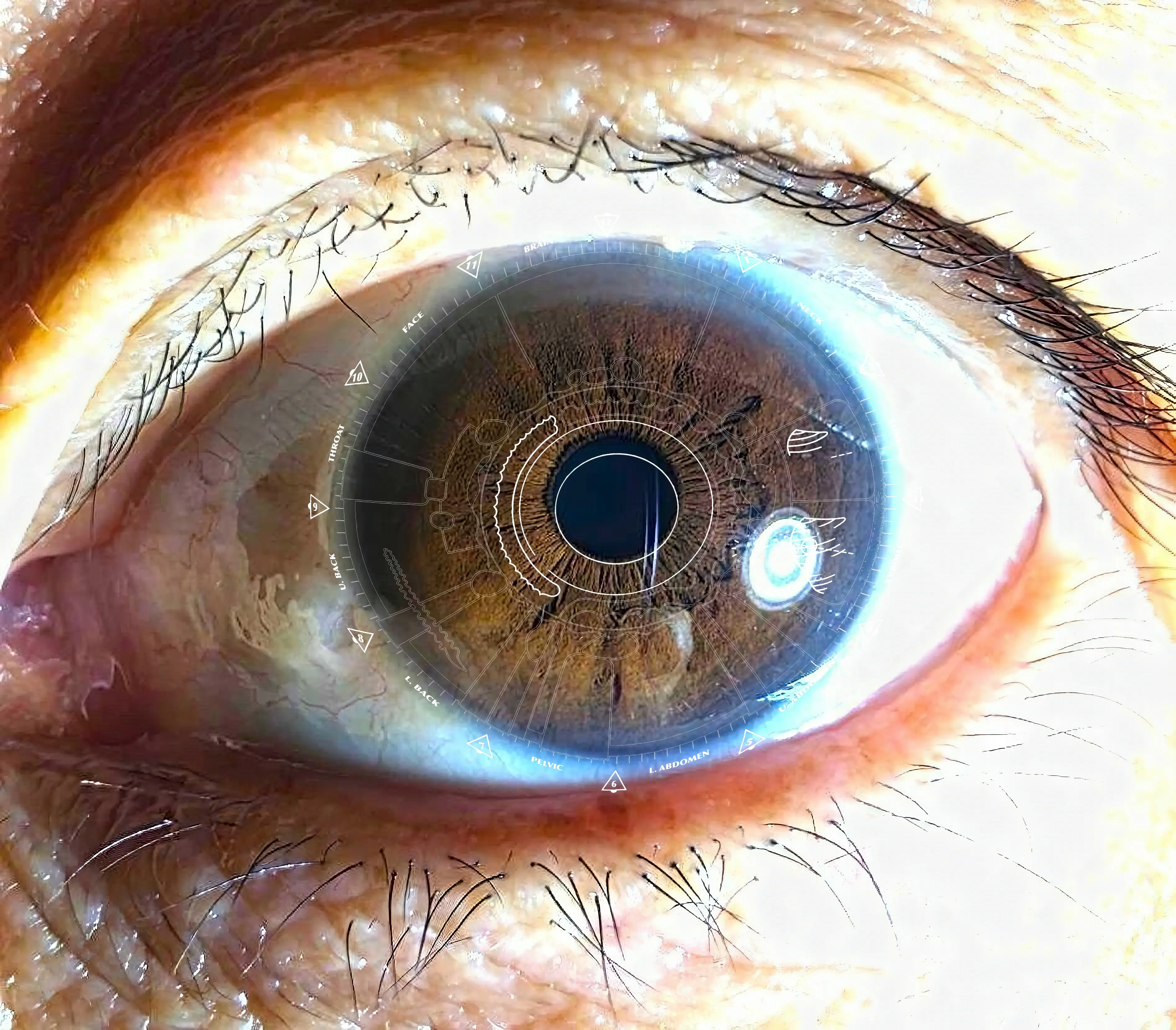 Detailed iris reading analysis showing digestive health status