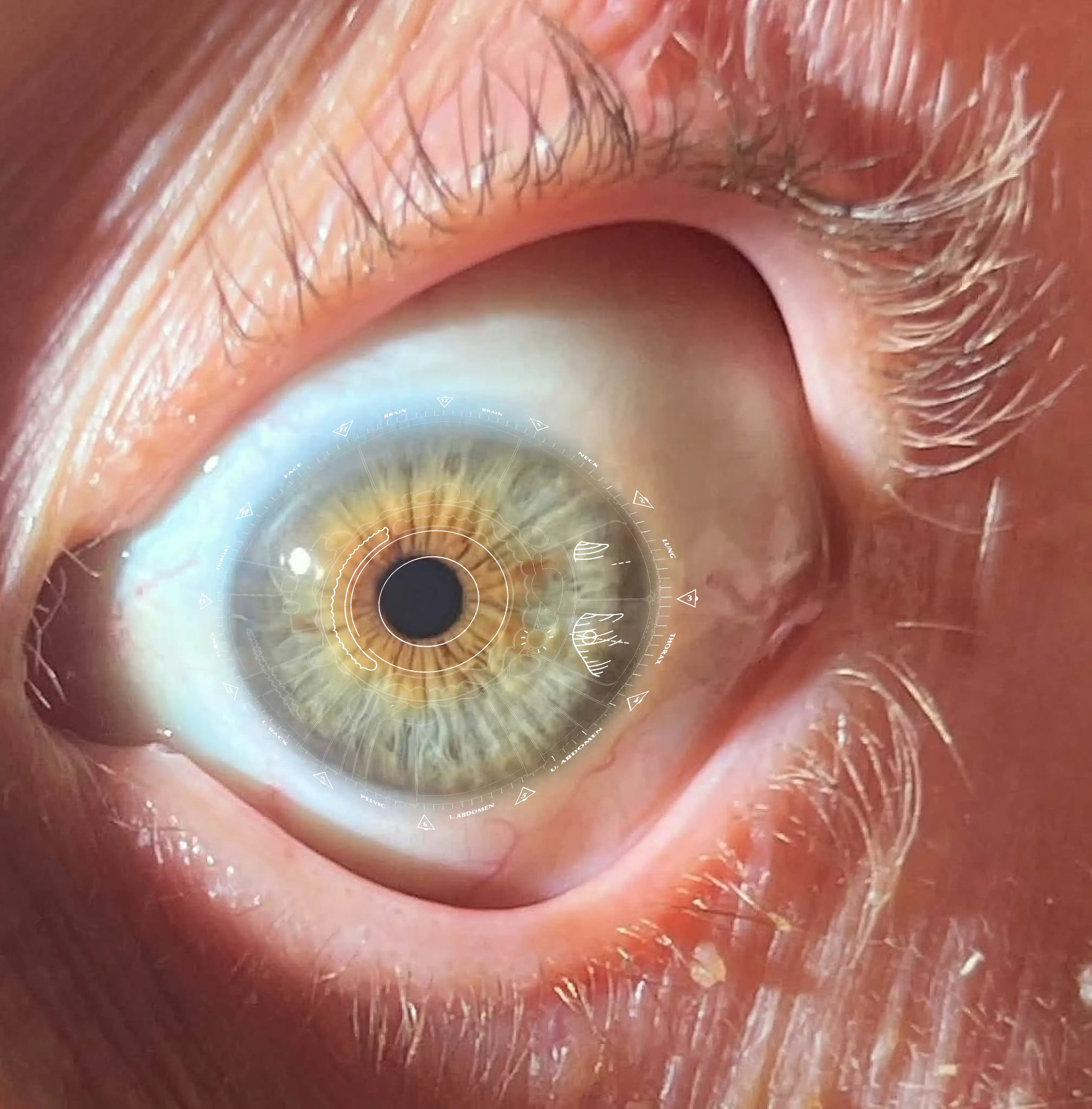 Iridology assessment chart tracking cellular detox and lymphatic system improvements