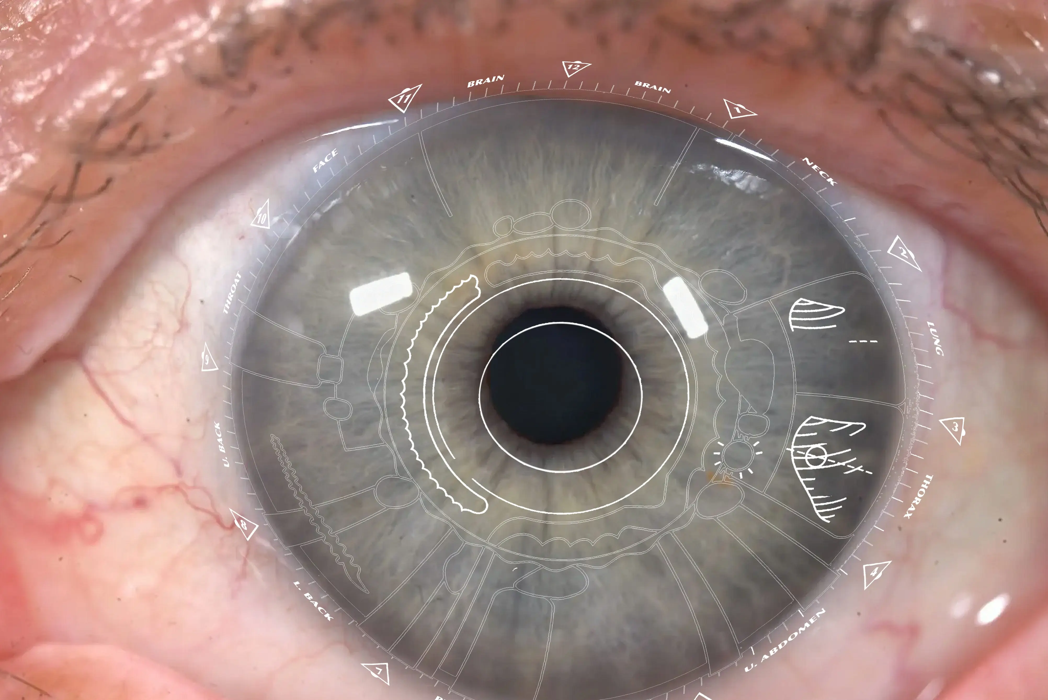 Iris scan details pointing to liver cleanse and kidney cleanse priorities